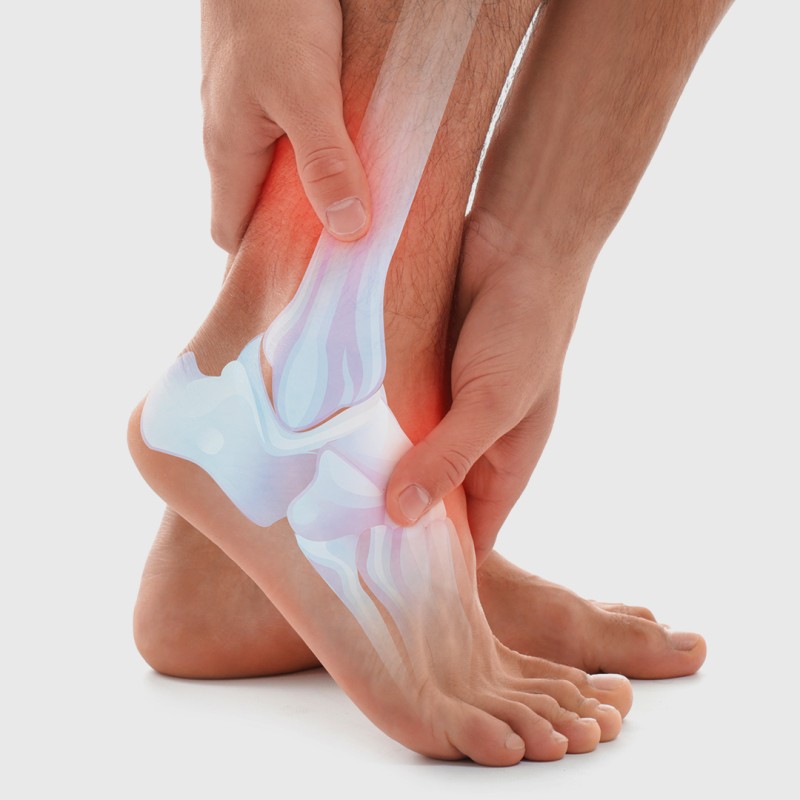 Osteoarthritis